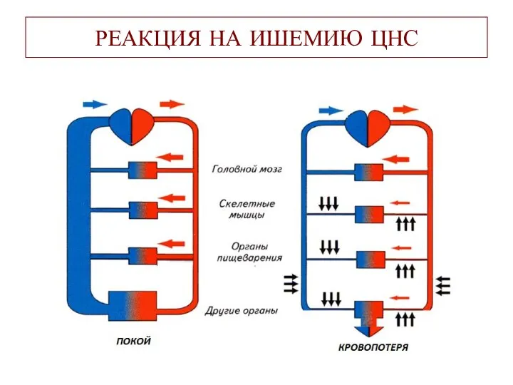 РЕАКЦИЯ НА ИШЕМИЮ ЦНС