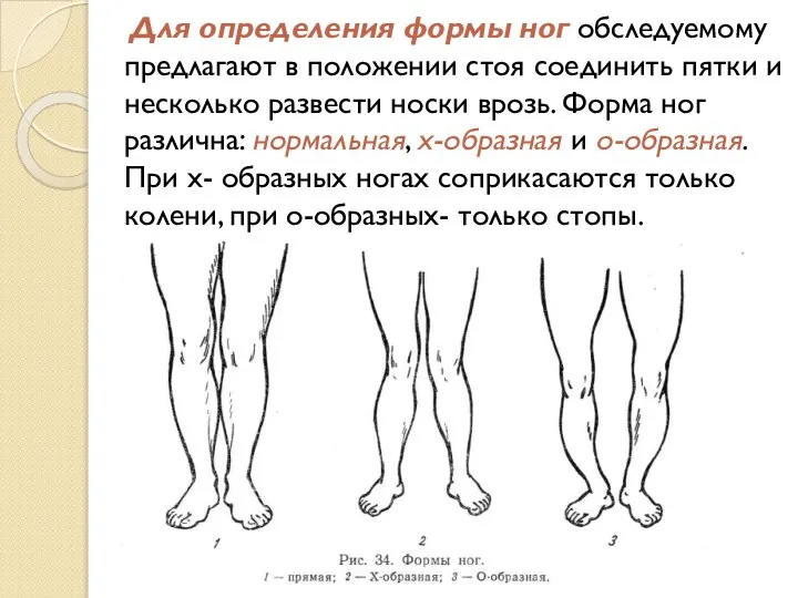 Для определения формы ног обследуемому предлагают в положении стоя соединить пятки