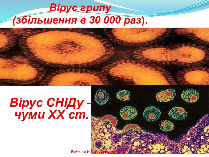 Вірус грипу (збільшення в 30 000 раз). Вірус СНІДу – чуми