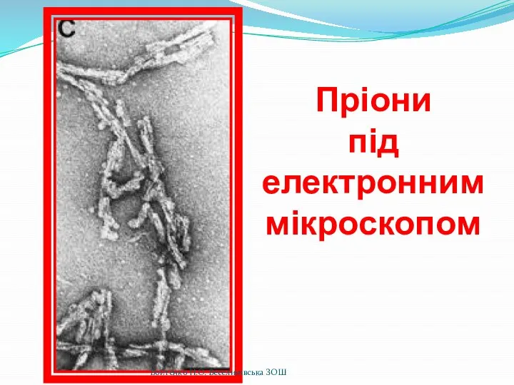 Пріони під електронним мікроскопом Войтенко Н.О. Веселинівська ЗОШ