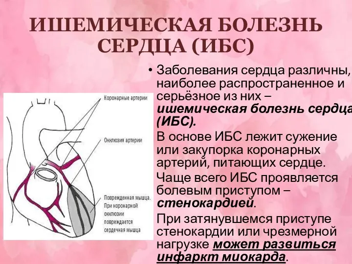 ИШЕМИЧЕСКАЯ БОЛЕЗНЬ СЕРДЦА (ИБС) Заболевания сердца различны, наиболее распространенное и серьёзное