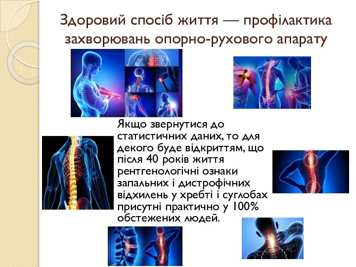 Здоровий спосіб життя — профілактика захворювань опорно-рухового апарату Якщо звернутися до