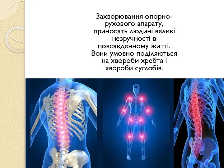 Захворювання опорно-рухового апарату, приносять людині великі незручності в повсякденному житті. Вони