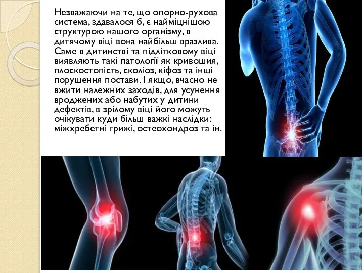 Незважаючи на те, що опорно-рухова система, здавалося б, є найміцнішою структурою