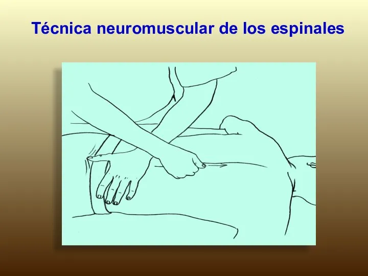 Técnica neuromuscular de los espinales