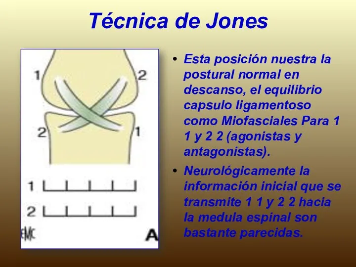 Técnica de Jones Esta posición nuestra la postural normal en descanso,