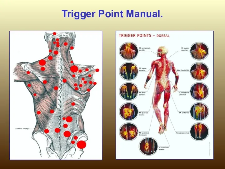 Trigger Point Manual.