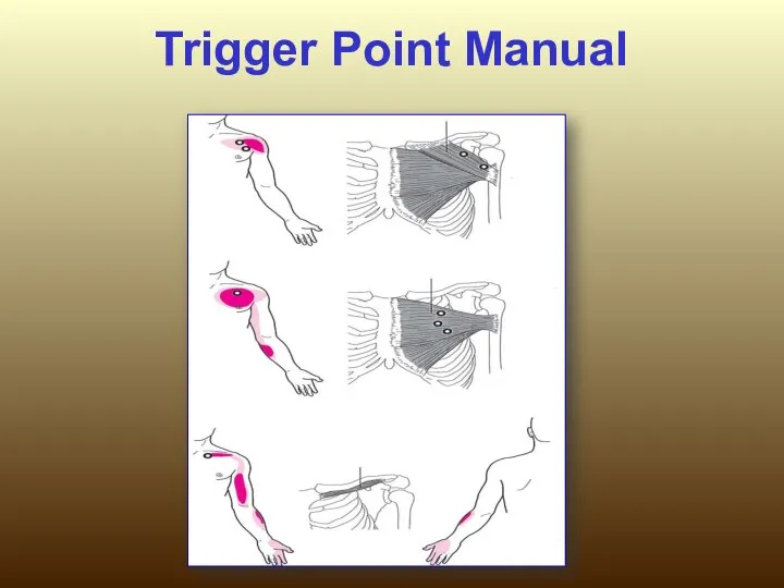 Trigger Point Manual