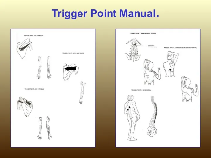 Trigger Point Manual.