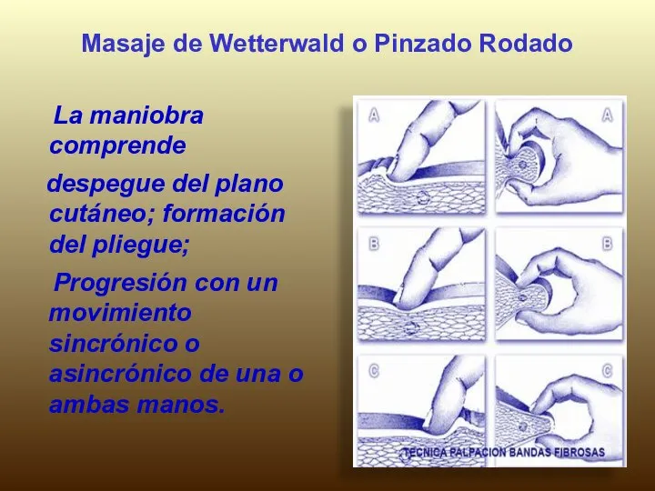 Masaje de Wetterwald o Pinzado Rodado La maniobra comprende despegue del