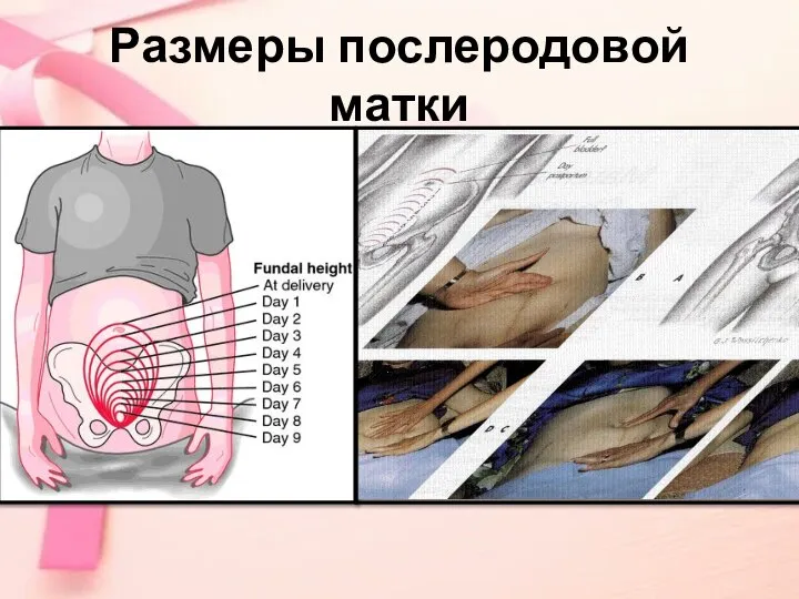 Размеры послеродовой матки