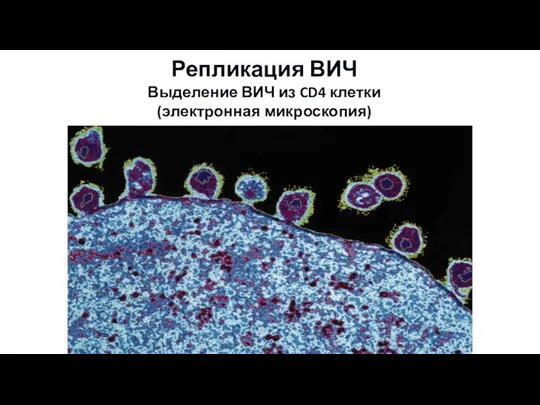 Репликация ВИЧ Выделение ВИЧ из CD4 клетки (электронная микроскопия)