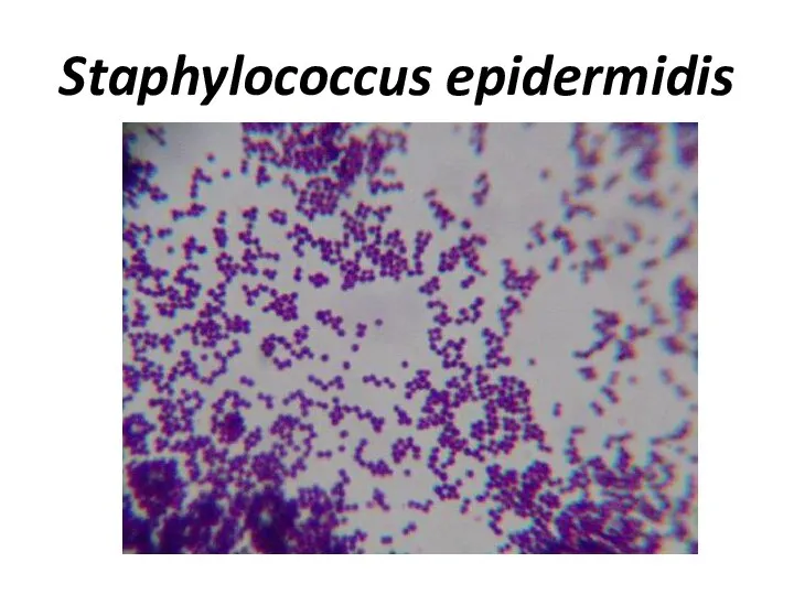 Staphylococcus epidermidis