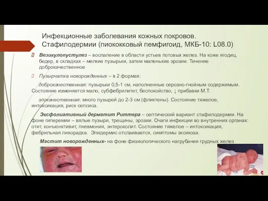 Инфекционные заболевания кожных покровов. Стафилодермии (пиококковый пемфигоид, МКБ-10: L08.0) Везикулопустулез –