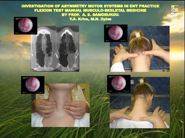 INVESTIGATION OF ASYMMETRY MOTOR SYSTEMS IN ENT PRACTICE FLEXION TEST MANUAL