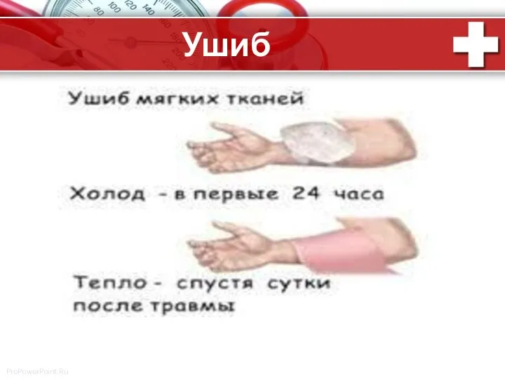 Ушиб