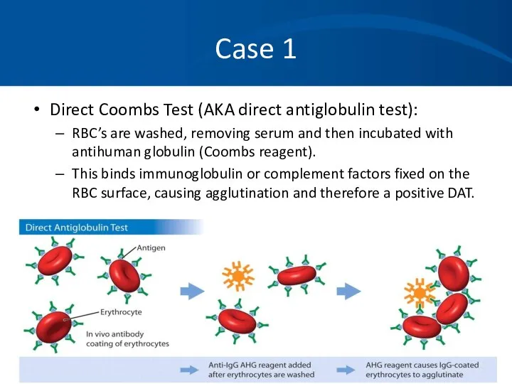 Case 1 Direct Coombs Test (AKA direct antiglobulin test): RBC’s are