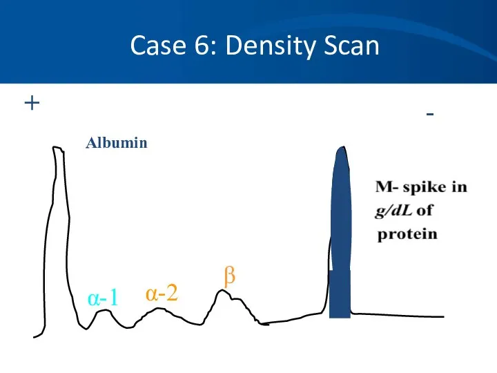 Case 6: Density Scan + - Albumin α-1 α-2 β