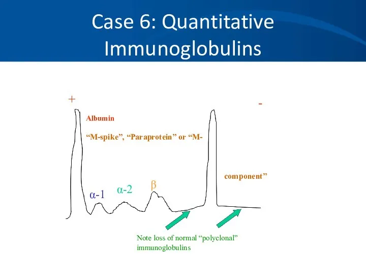 Case 6: Quantitative Immunoglobulins + - Albumin “M-spike”, “Paraprotein” or “M-