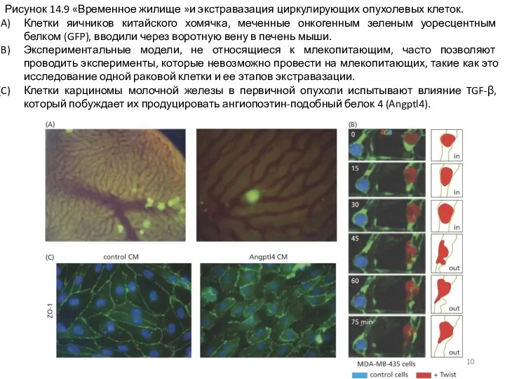 Рисунок 14.9 «Временное жилище »и экстравазация циркулирующих опухолевых клеток. Клетки яичников