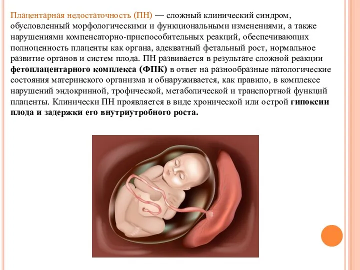 Плацентарная недостаточность (ПН) — сложный клинический синдром, обусловленный морфологическими и функциональными