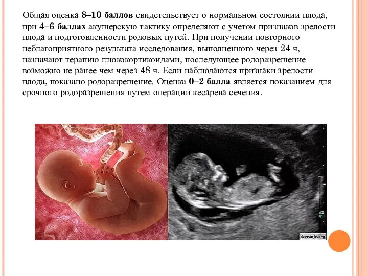 Общая оценка 8–10 баллов свидетельствует о нормальном состоянии плода, при 4–6