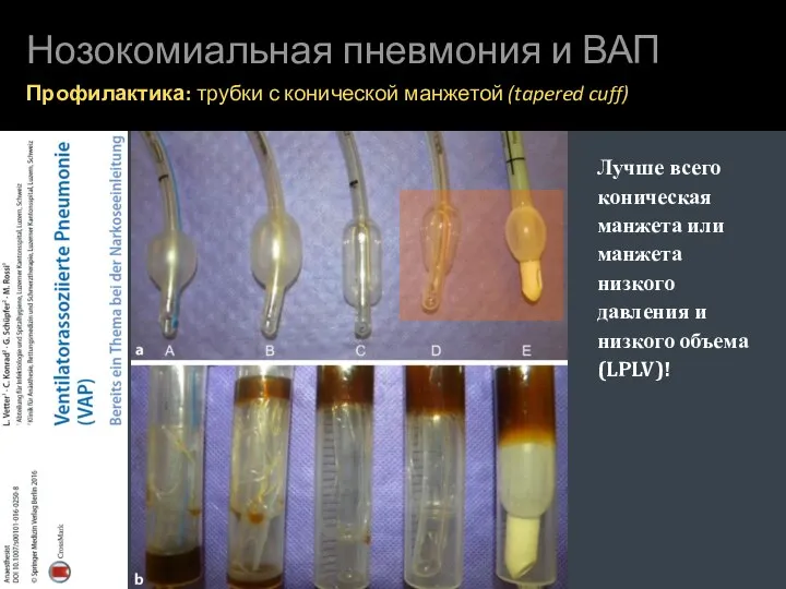 Нозокомиальная пневмония и ВАП Профилактика: трубки с конической манжетой (tapered cuff)