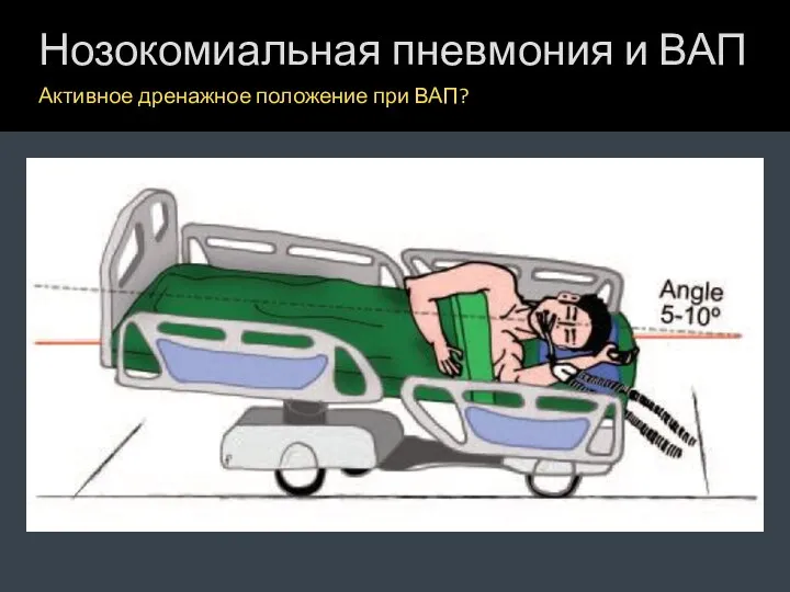 Нозокомиальная пневмония и ВАП Активное дренажное положение при ВАП?