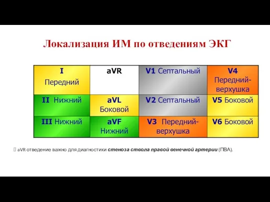 Локализация ИМ по отведениям ЭКГ aVR отведение важно для диагностики стеноза ствола правой венечной артерии (ПВА).