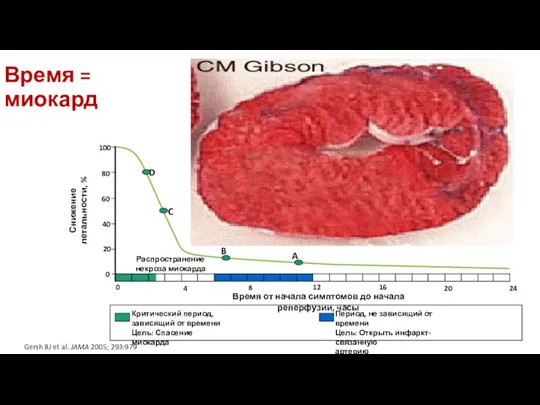 Gersh BJ et al. JAMA 2005; 293:979 B C A Распространение