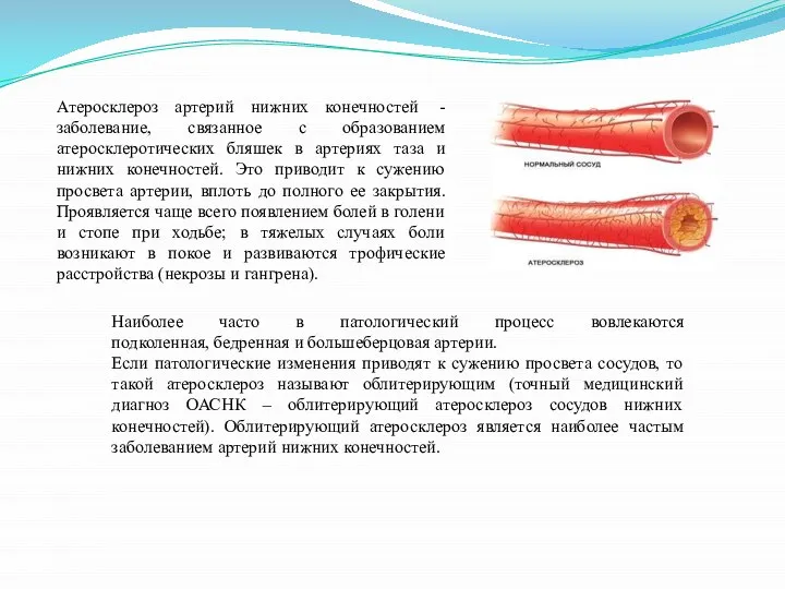 Атеросклероз артерий нижних конечностей - заболевание, связанное с образованием атеросклеротических бляшек