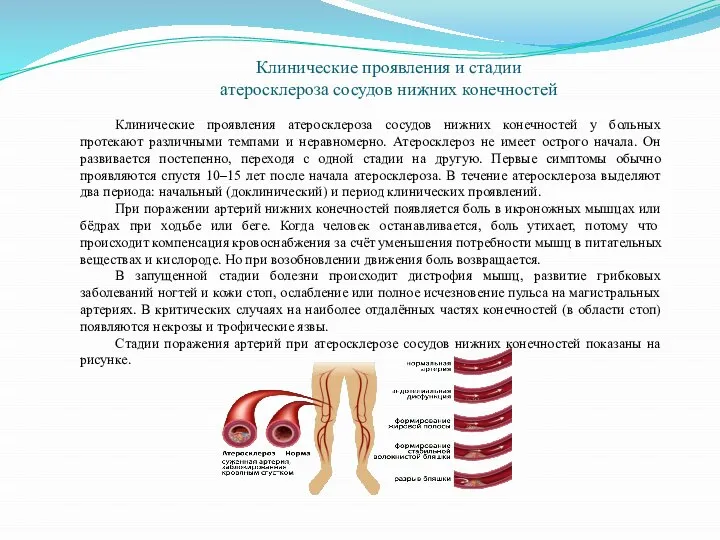Клинические проявления и стадии атеросклероза сосудов нижних конечностей Клинические проявления атеросклероза