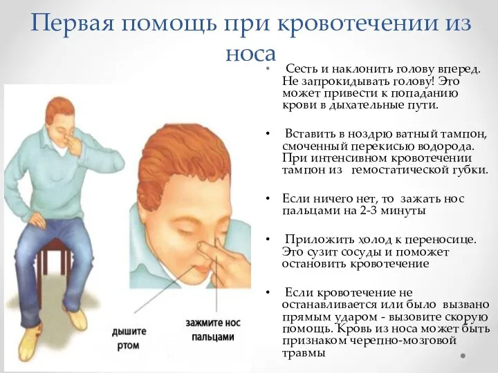 Первая помощь при кровотечении из носа Сесть и наклонить голову вперед.