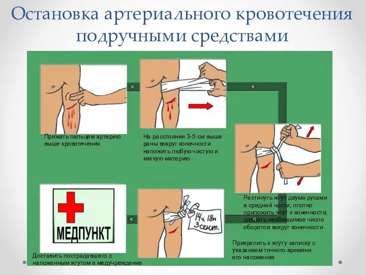 Остановка артериального кровотечения подручными средствами Прижать пальцем артерию выше кровотечения На