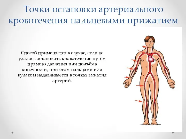 Точки остановки артериального кровотечения пальцевыми прижатием Способ применяется в случае, если