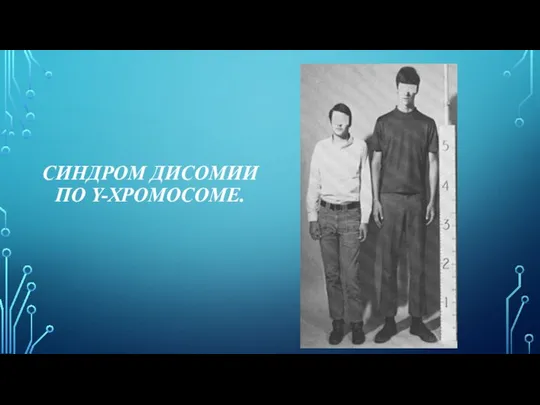 СИНДРОМ ДИСОМИИ ПО Y-ХРОМОСОМЕ.