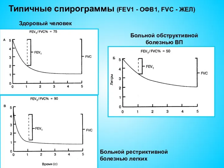 Типичные спирограммы (FEV1 - ОФВ1, FVC - ЖЕЛ) Здоровый человек Больной