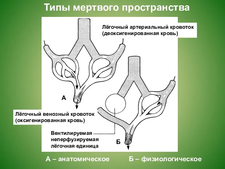 Типы мертвого пространства А – анатомическое Б – физиологическое Лёгочный артериальный