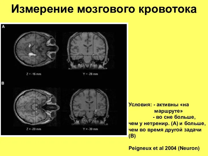 Измерение мозгового кровотока Условия: - активны «на маршруте» - во сне