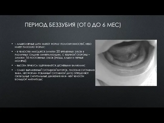 ПЕРИОД БЕЗЗУБИЯ (ОТ 0 ДО 6 МЕС) - альвеолярные дуги имеют