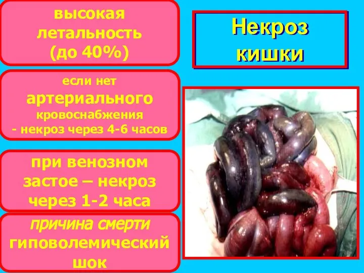 Некроз кишки высокая летальность (до 40%) если нет артериального кровоснабжения -