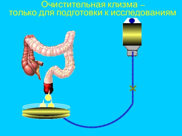 Очистительная клизма – только для подготовки к исследованиям