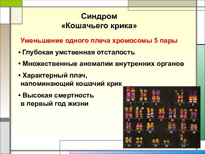 Синдром «Кошачьего крика» Уменьшение одного плеча хромосомы 5 пары Глубокая умственная