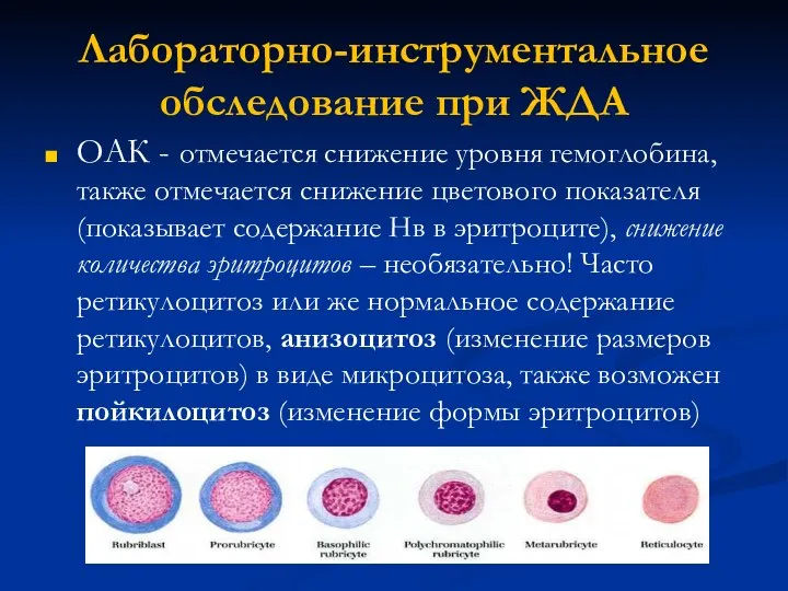 Лабораторно-инструментальное обследование при ЖДА ОАК - отмечается снижение уровня гемоглобина, также