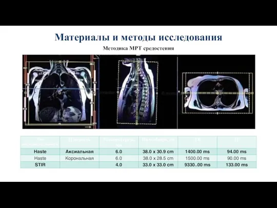 Материалы и методы исследования Методика МРТ средостения