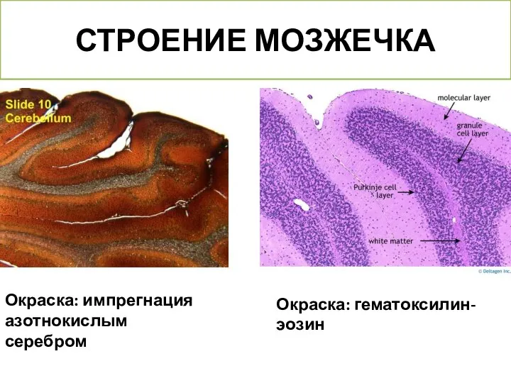 СТРОЕНИЕ МОЗЖЕЧКА Окраска: импрегнация азотнокислым серебром Окраска: гематоксилин-эозин