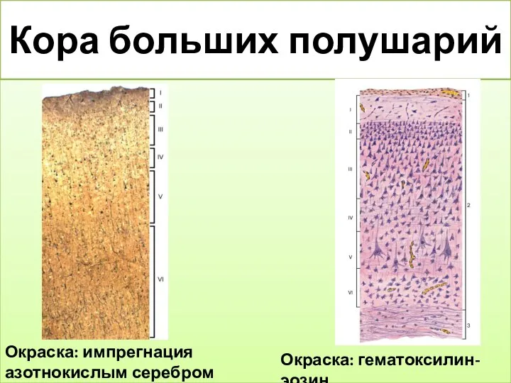 Кора больших полушарий Окраска: импрегнация азотнокислым серебром Окраска: гематоксилин-эозин