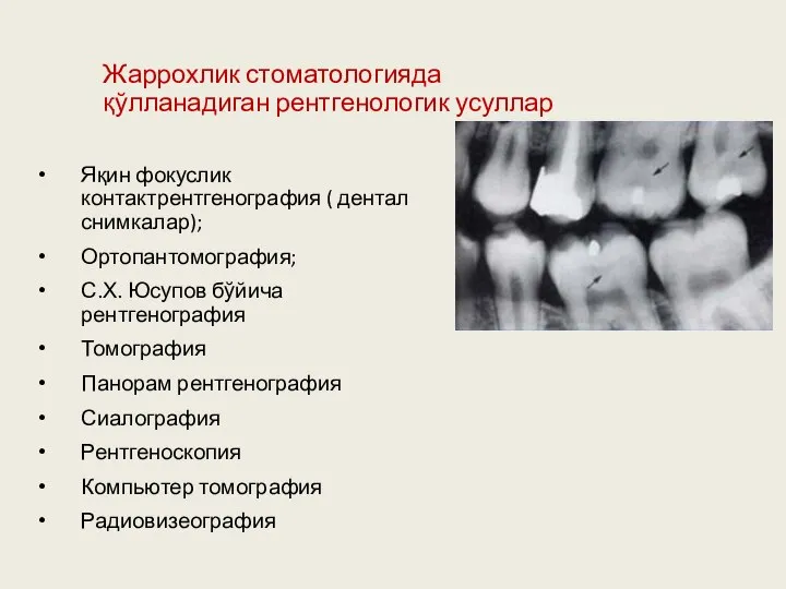 Жаррохлик стоматологияда қўлланадиган рентгенологик усуллар Яқин фокуслик контактрентгенография ( дентал снимкалар);