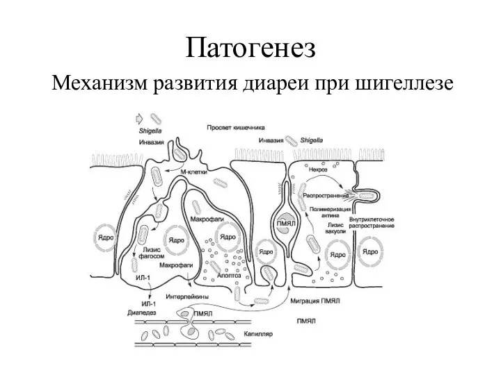 Патогенез Механизм развития диареи при шигеллезе