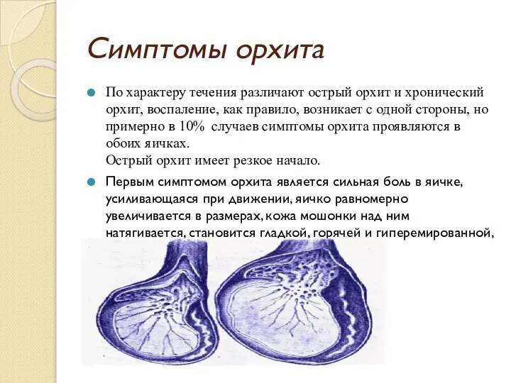 Симптомы орхита По характеру течения различают острый орхит и хронический орхит,